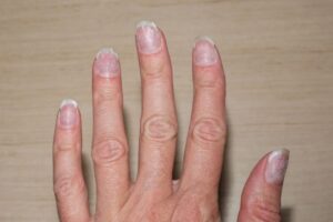 unghie della mano