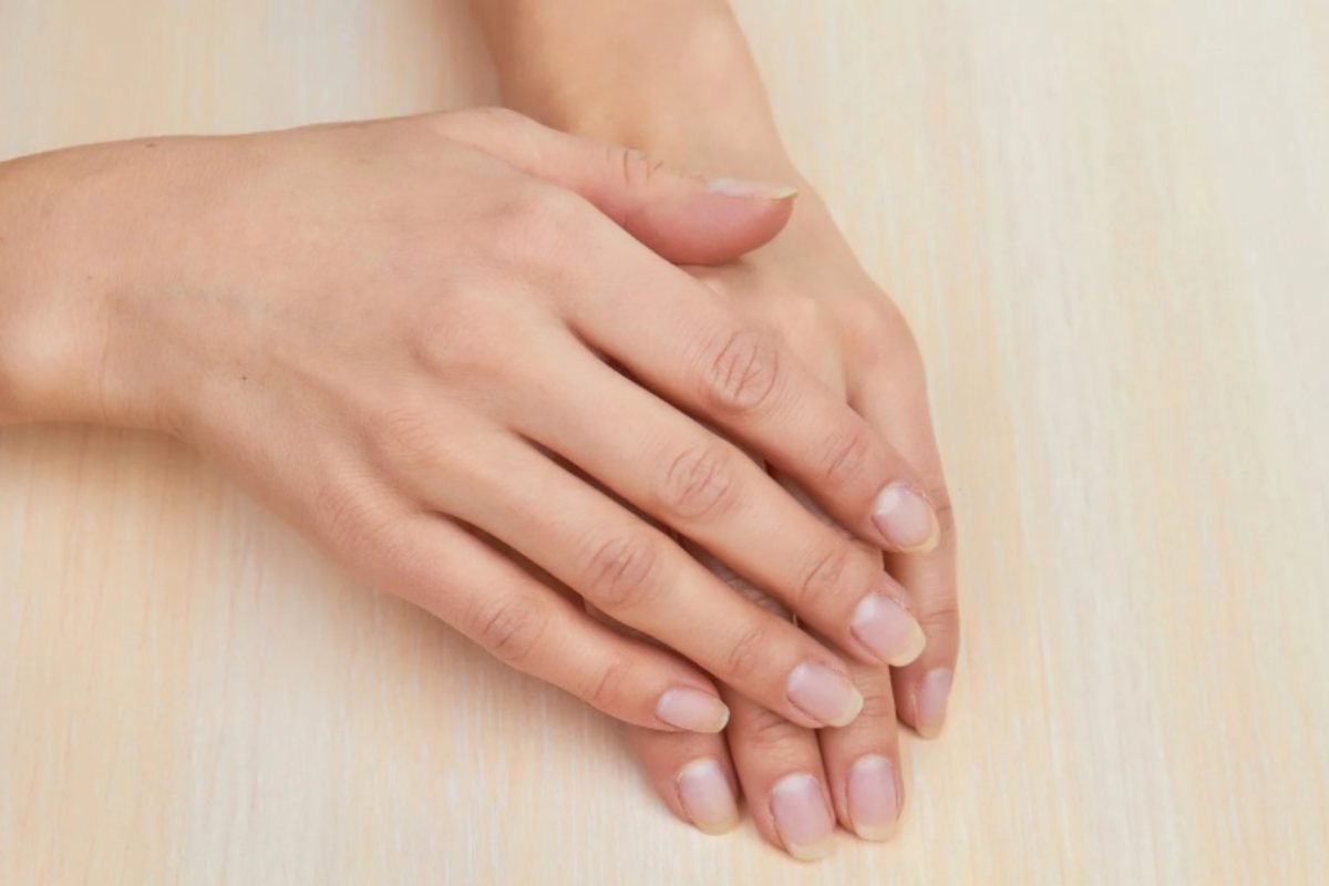 Cause delle unghie rigate legate alla tiroide: questi i segnali